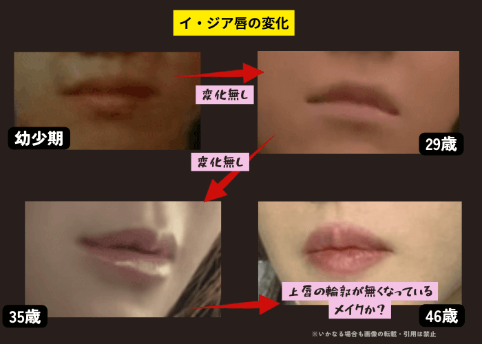 韓国女優イ・ジアの唇の変化について時系列検証画像
以下4枚の画像

幼少期（左上画像）
29歳（右上画像）
35歳（左下画像）
46歳（右下画像）
46歳現在の画像は、上唇の輪郭がなく、ぽってりした唇の印象。